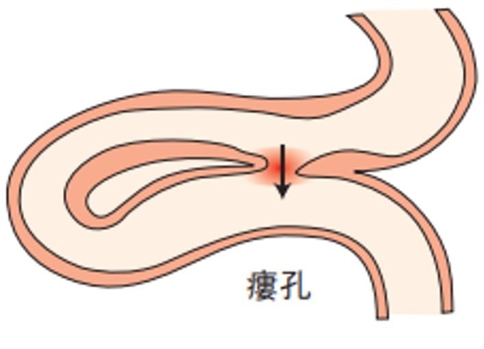 いつ医師に連絡するべきか